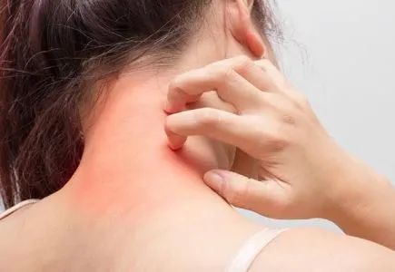 Itchy Bumps or folliculitis-Causes-Diagnosis-Top Homeopathic doctor in Pakistan-Dr Qaisar Ahmed-Al Haytham clinic-Risalpur