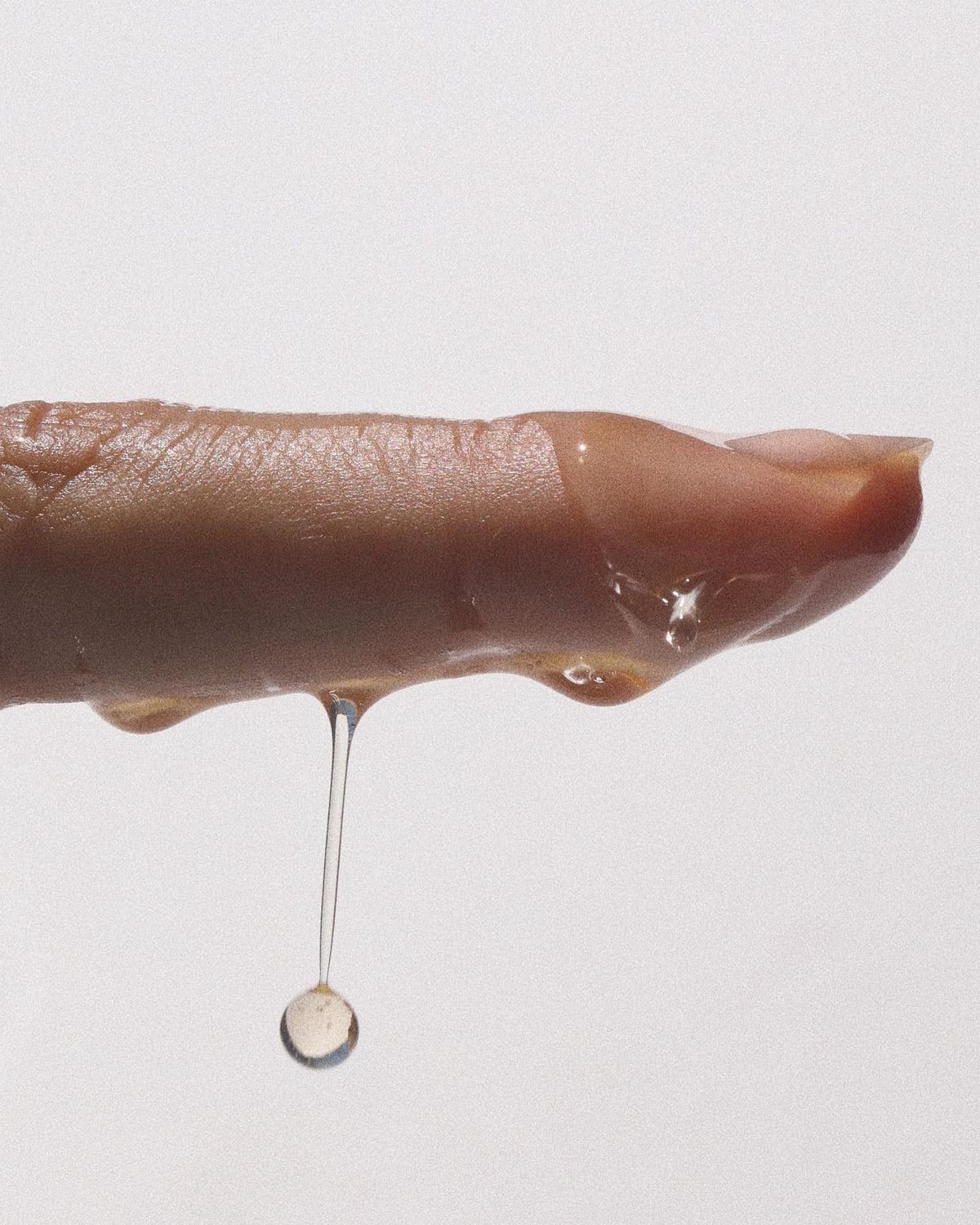 Cervical Mucus - Dryness - Changes | Homeopathic | Best Homeopathic Doctor in Pakistan | Dr Qaisar Ahmed MD, DHMS